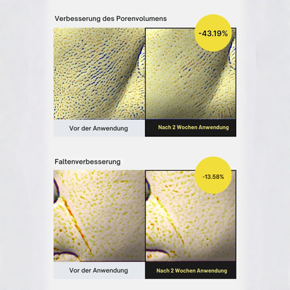 Vita-A Straffungs-Set (Serum + Booster)
